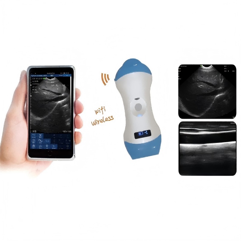 vc 3ml micro convexlinear probe type wireless color doppler scanner