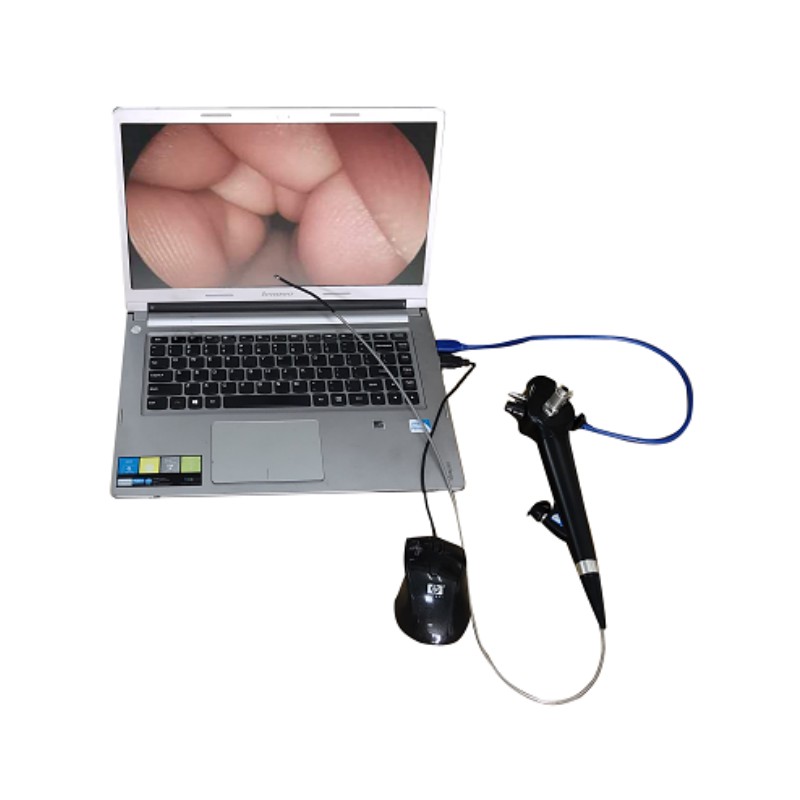 ved gbs3 video ureteroscope