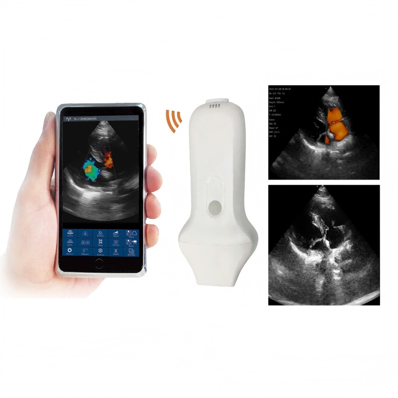 vc 4pa phased array probe type wireless color doppler scanner