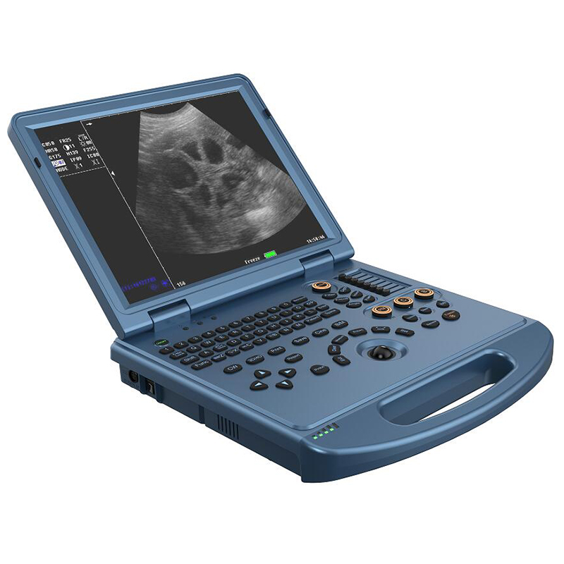 vc 6 portable color doppler ultrasound scanner