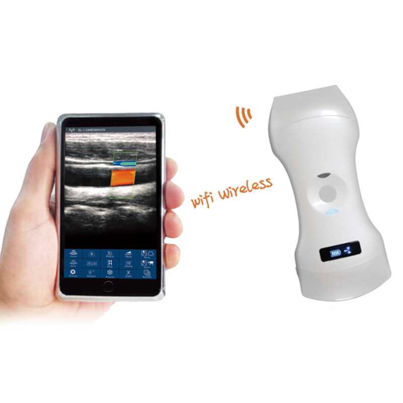 vc 3 in 1 double head probe type wireless ultrasound scanner