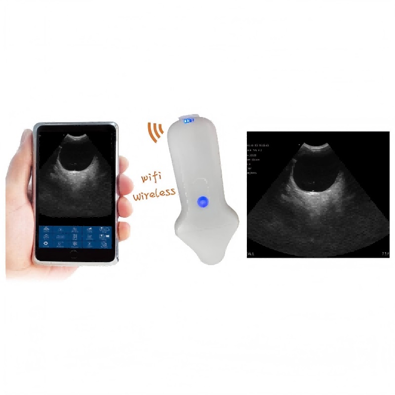 vc 3m micro convex probe type wireless color doppler scanner